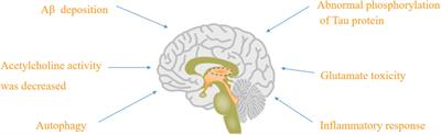 Current and future therapeutic strategies for Alzheimer’s disease: an overview of drug development bottlenecks